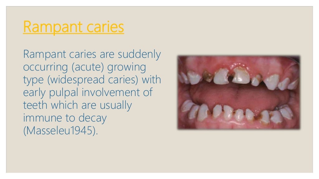 Early childhood caries, rampant, chronic and arrested caries