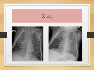 X ray 
 