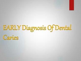 EARLY Diagnosis Of Dental
Caries
 