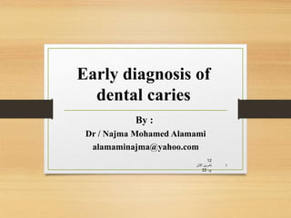 Early diagnosis of
dental caries
By :
Dr / Najma Mohamed Alamami
alamaminajma@yahoo.com
12
‫تشرين‬
‫الث‬
‫ان‬
،‫ي‬
22
1
 