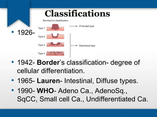 Classifications 
• 1926- 
• 1942- Border’s classification- degree of 
cellular differentiation. 
• 1965- Lauren- Intestinal, Diffuse types. 
• 1990- WHO- Adeno Ca., AdenoSq., 
SqCC, Small cell Ca., Undifferentiated Ca. 
 