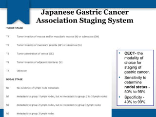 Japanese Gastric Cancer 
Association Staging System 
• CECT- the 
modality of 
choice for 
staging of 
gastric cancer. 
• Sensitivity to 
determine 
nodal status - 
50% to 95% 
• Specificity - 
40% to 99%. 
 