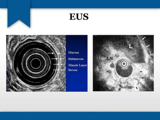 EUS 
 