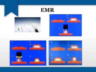 EMR 
 