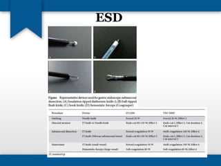 ESD 
 
