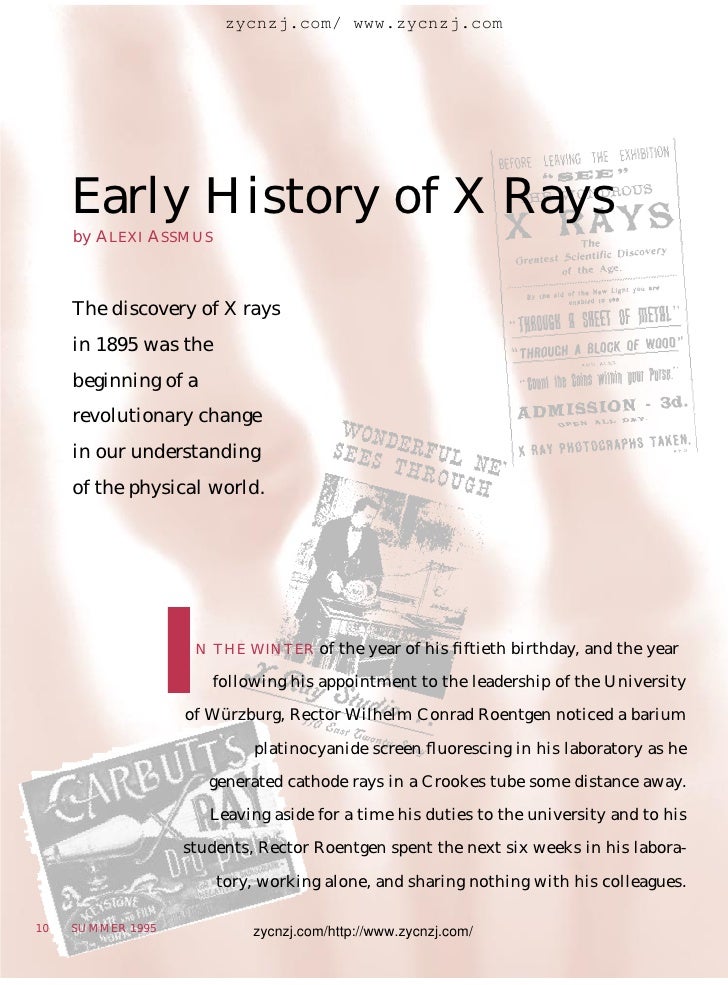 Early history of x rays
