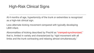 H Slightly More Development Risk early intervention in high risk infants.pptx