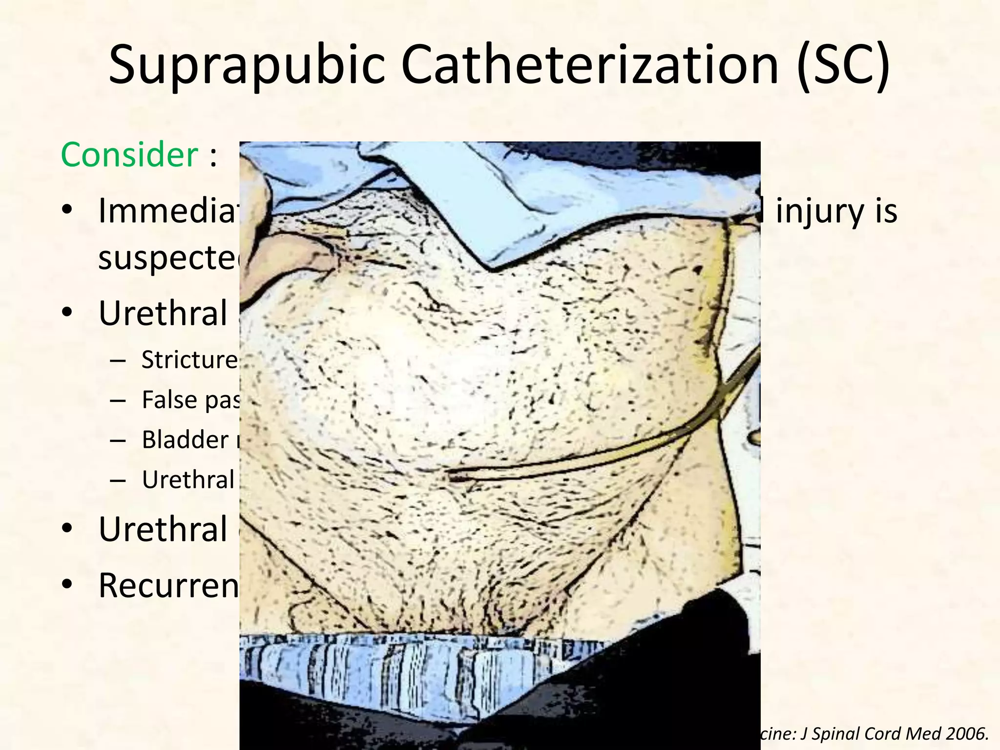 Suprapubic Catheterization (SC)
Consider :
• Immediately following acute SCI if urethral injury is
suspected, especially after pelvic trauma
• Urethral abnormalities
– Stricture
– False passages
– Bladder neck obstruction
– Urethral fistula.
• Urethral discomfort.
• Recurrent urethral catheter obstruction.
Consortium for Spinal Cord Medicine: J Spinal Cord Med 2006.
 