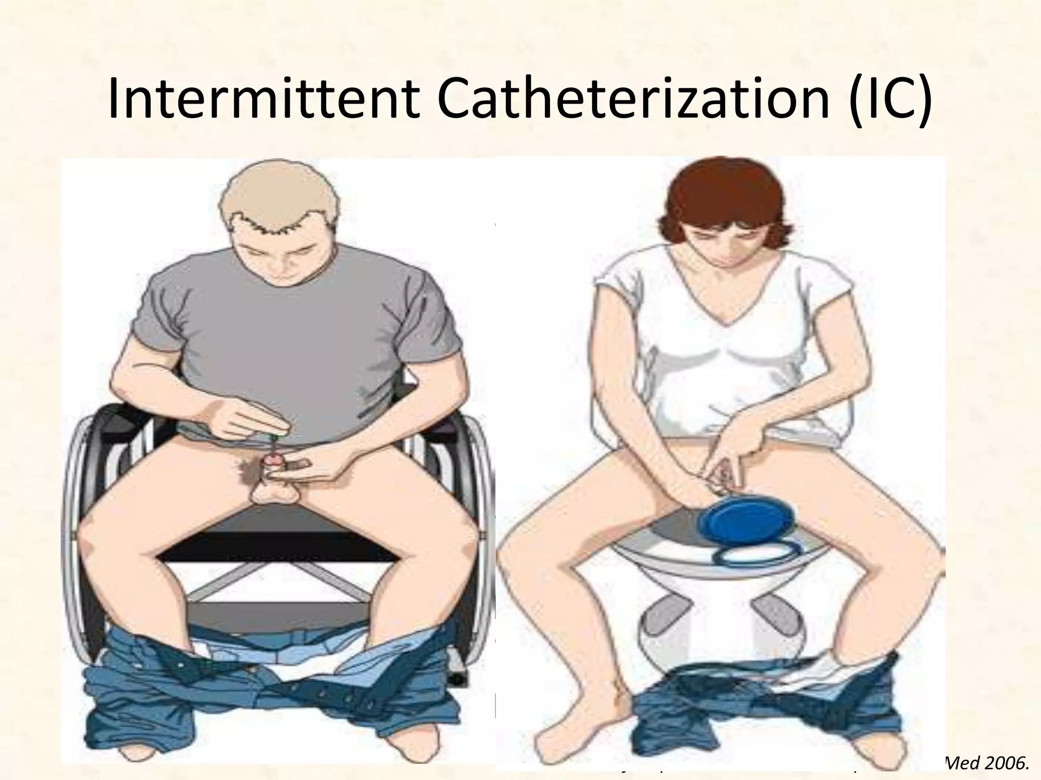 Intermittent Catheterization (IC)
• Effective alternative during spinal shock when the
bladder is not contracting
• IC provides complete bladder emptying and offers a
practical means of obtaining a catheter-free state
• Advantages:
– No changes in cosmesis
– No Interference with social/sexual functioning
– Reversibility
• Should be considered for patients with sufficient hand
skills or a willing caregiver to perform IC
• Institute clean IC training prior to discharge
Consortium for Spinal Cord Medicine: J Spinal Cord Med 2006.
 