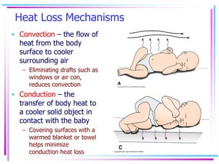 Heat Loss Mechanisms
• Convection – the flow of
heat from the body
surface to cooler
surrounding air
– Eliminating drafts ...