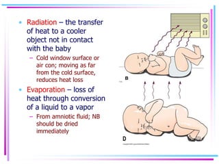 • Radiation – the transfer
of heat to a cooler
object not in contact
with the baby
– Cold window surface or
air con; movin...