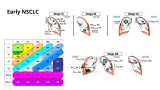 management of early non-small cell lung cancer | PPTX
