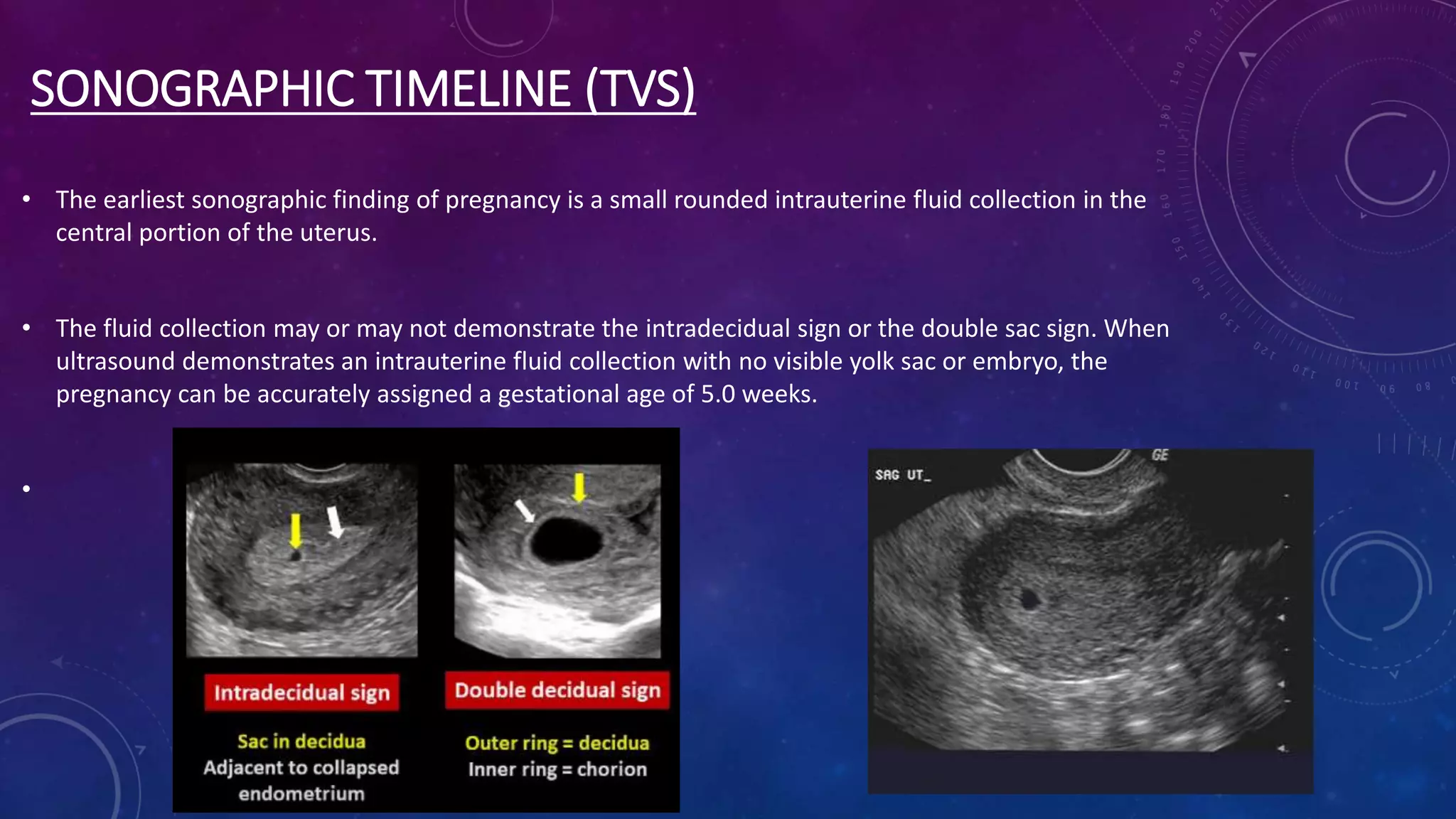 Acnormal Usg Week Early OG USG Protocol (1).pptx