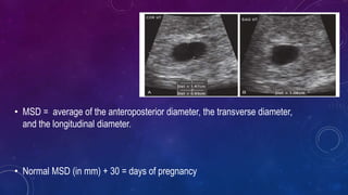 • MSD = average of the anteroposterior diameter, the transverse diameter,
and the longitudinal diameter.
• Normal MSD (in mm) + 30 = days of pregnancy
 