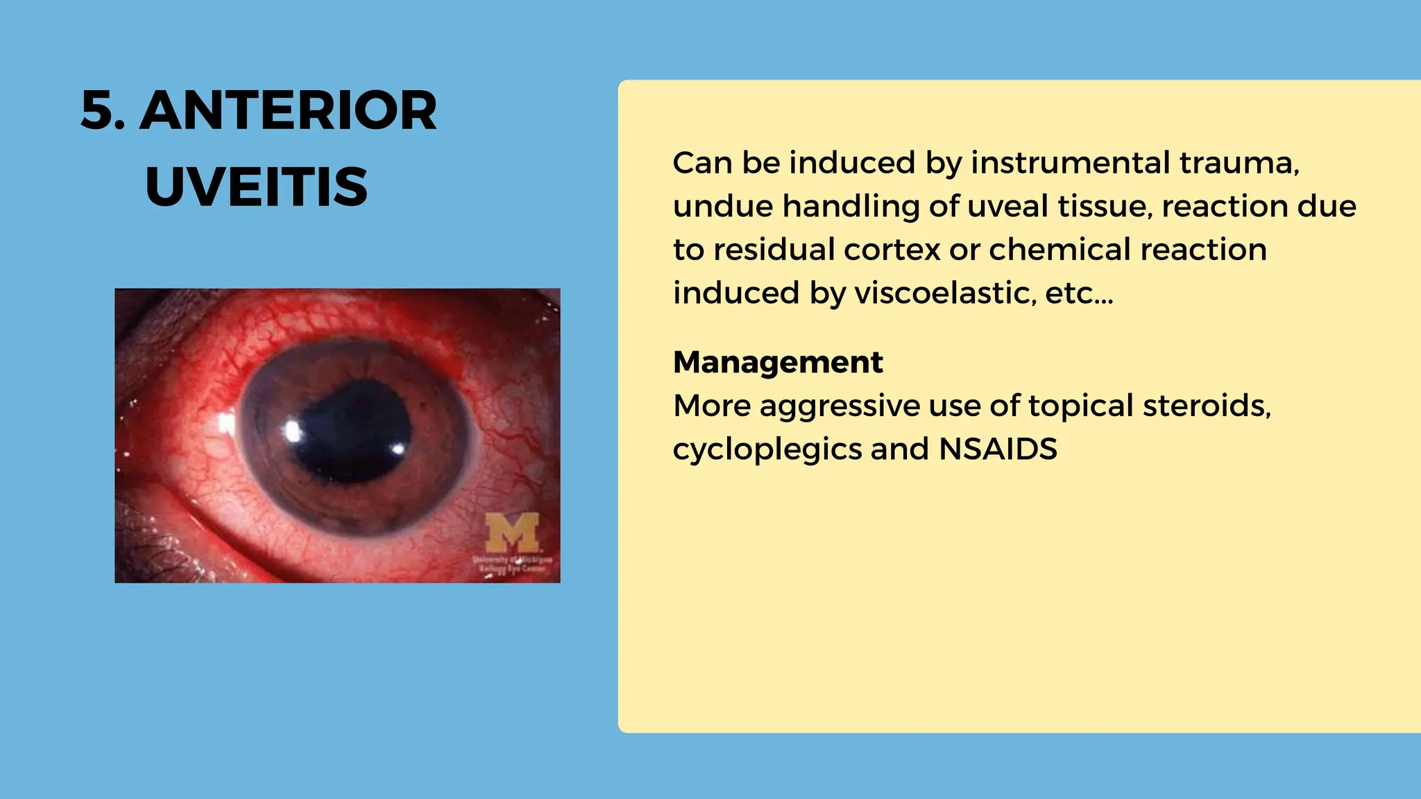 early-post-operative-complications-of-cataract-surgery-20230914-004137