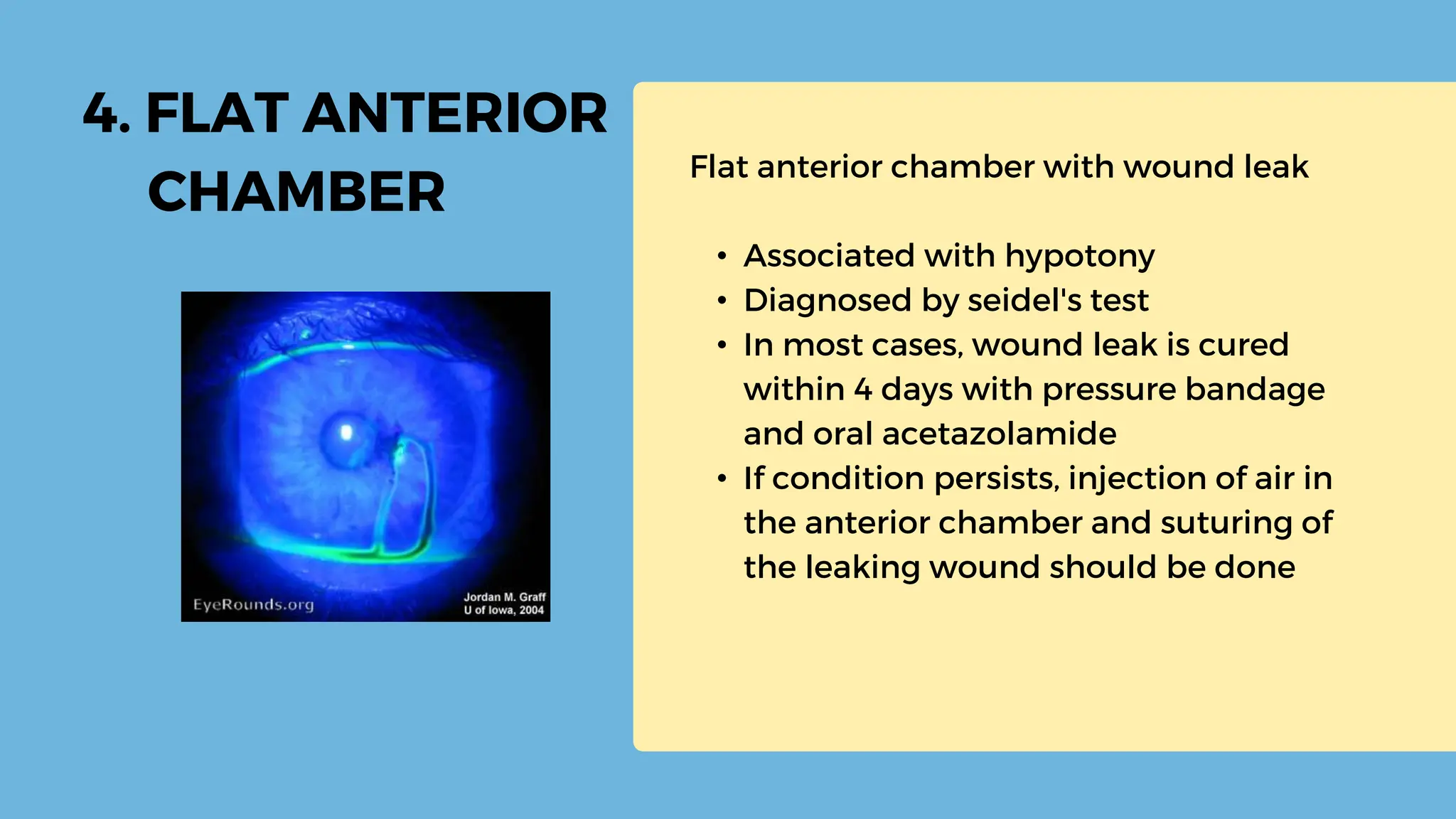 early-post-operative-complications-of-cataract-surgery-20230914-004137