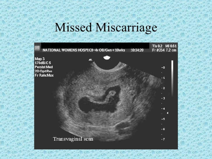 Gynecology 5th year, 3rd & 4th lectures (Dr. Muhabat Salih