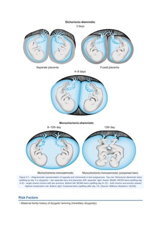 Right Chorionic Early Pregnancy Complications and Multiple Pregnancy Management | PDF