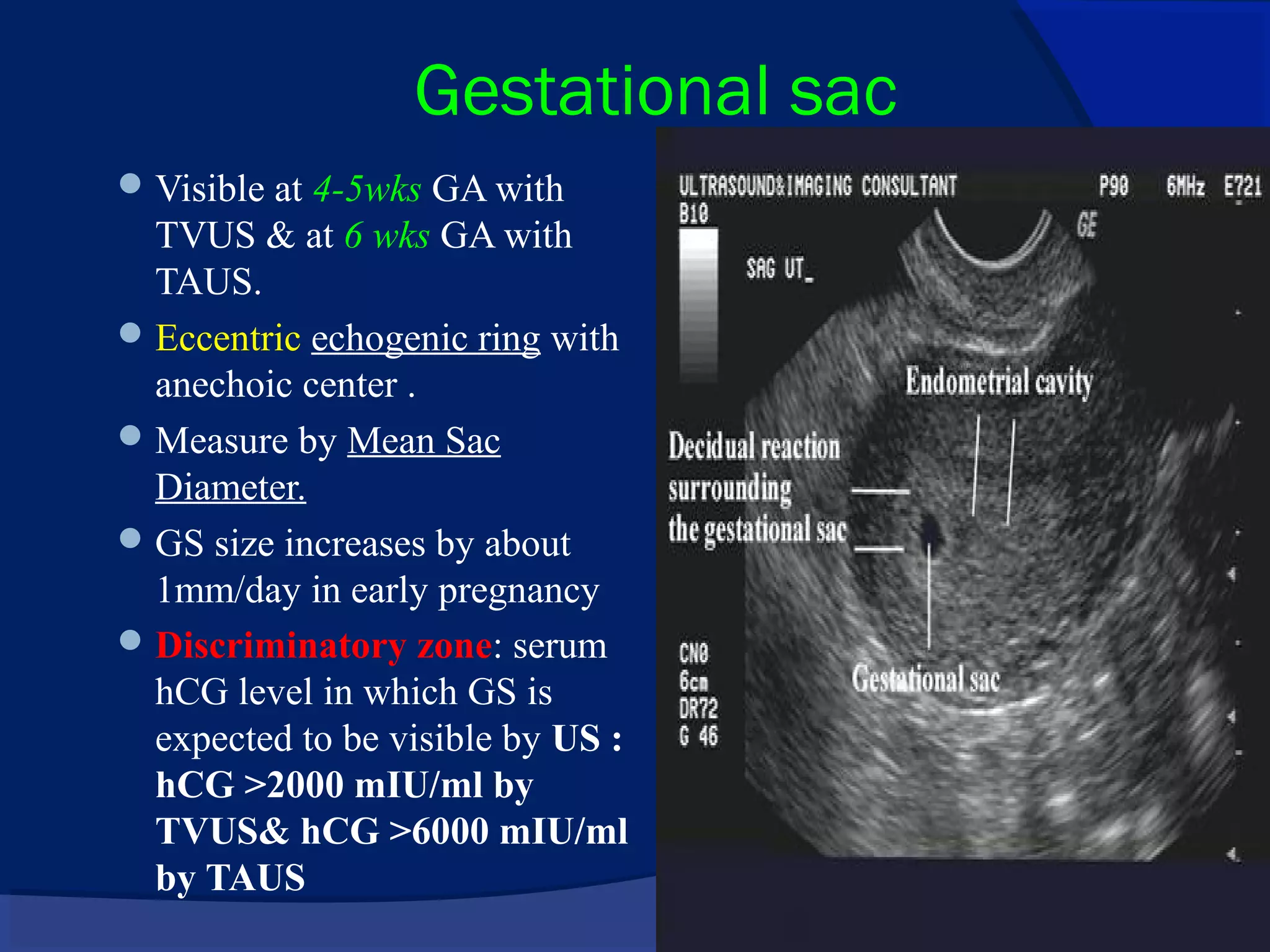Early Pregnancy Ultrasonographic Evaluation PPT