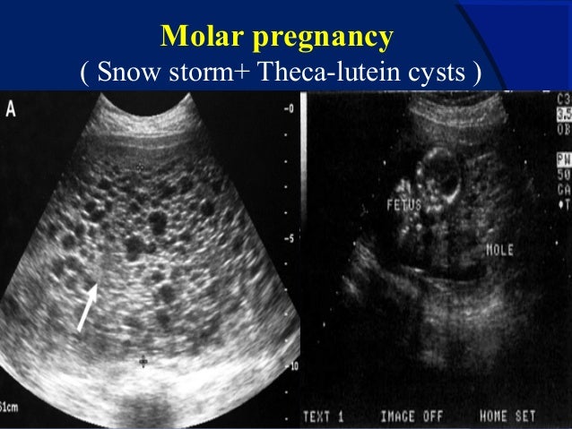 Early pregnancy ultrasonographic evaluation