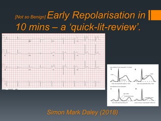 [Not so Benign] Early Repolarisation in
10 mins – a ‘quick-lit-review’.
Simon Mark Daley (2018)
 