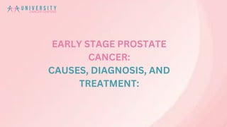 EARLY STAGE PROSTATE
CANCER:
CAUSES, DIAGNOSIS, AND
TREATMENT:
 