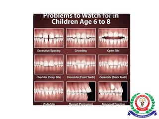 EARLY VERSUS LATE ORTHODONTIC TREATMENT.pptx