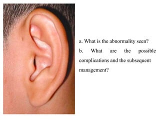 a. What is the abnormality seen?
b. What are the possible
complications and the subsequent
management?
 