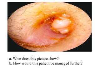 a. What does this picture show?
b. How would this patient be managed further?
 