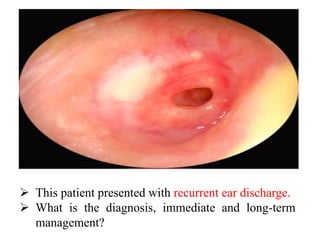  This patient presented with recurrent ear discharge.
 What is the diagnosis, immediate and long-term
management?
 