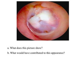 a. What does this picture show?
b. What would have contributed to this appearance?
 