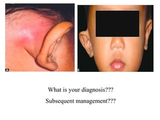 What is your diagnosis???
Subsequent management???
 