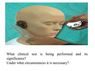 What clinical test is being performed and its
significance?
Under what circumstances it is necessary?
 