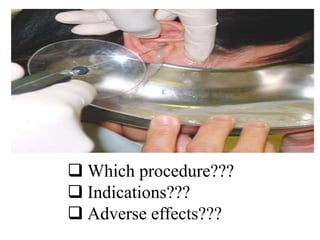  Which procedure???
 Indications???
 Adverse effects???
 