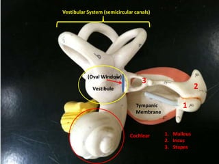 Vestibular System (semicircular canals)




           (Oval Window)
                                   3
             Vestibule                                  2

                                Tympanic         1
                                Membrane



                              Cochlear     1. Malleus
                                           2. Incus
                                           3. Stapes
 