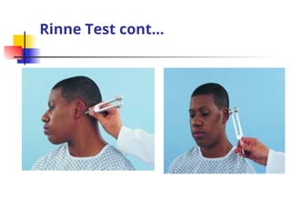 ear, nose and throat disorders best last edited.ppt