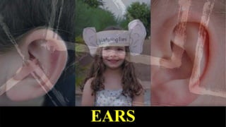 EARS
 