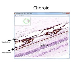 Choroid




 Vascular layer

                     Retina

Choriocapillaris
 