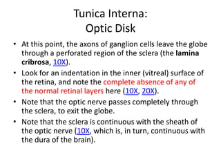 Tunica Interna:
                    Optic Disk
• At this point, the axons of ganglion cells leave the globe
  through a perforated region of the sclera (the lamina
  cribrosa, 10X).
• Look for an indentation in the inner (vitreal) surface of
  the retina, and note the complete absence of any of
  the normal retinal layers here (10X, 20X).
• Note that the optic nerve passes completely through
  the sclera, to exit the globe.
• Note that the sclera is continuous with the sheath of
  the optic nerve (10X, which is, in turn, continuous with
  the dura of the brain).
 