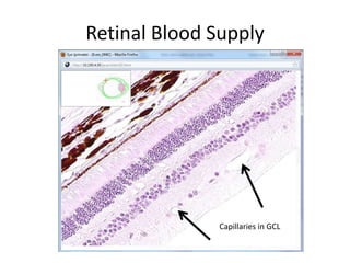Retinal Blood Supply




              Capillaries in GCL
 