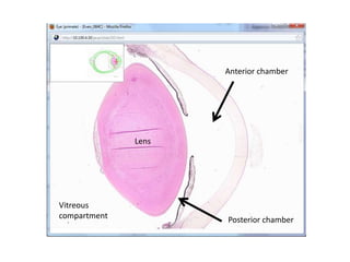 Anterior chamber




              Lens




Vitreous
compartment          Posterior chamber
 
