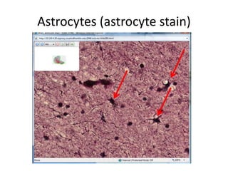 Astrocytes (astrocyte stain)
 