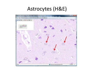 Astrocytes (H&E)
 