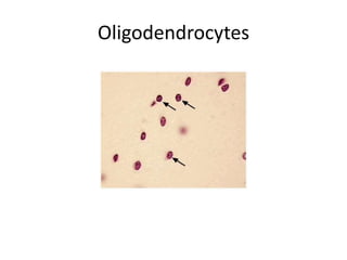 Oligodendrocytes
 