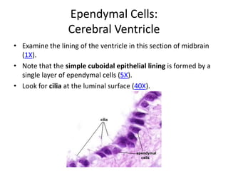 Ependymal Cells:
                 Cerebral Ventricle
• Examine the lining of the ventricle in this section of midbrain
  (1X).
• Note that the simple cuboidal epithelial lining is formed by a
  single layer of ependymal cells (5X).
• Look for cilia at the luminal surface (40X).
 