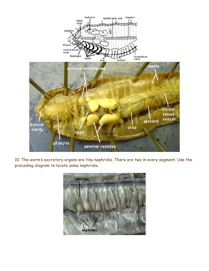 [36+] Earthworm Dissection Nephridia