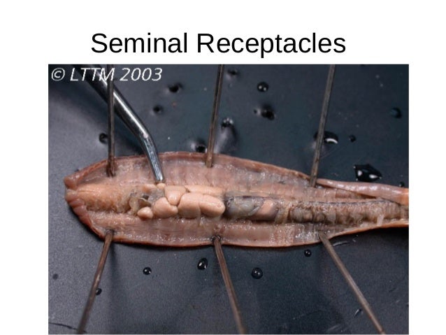 earthworm dissection aortic arches earthworm dissection earthworm dissection aortic arches earthworm dissection