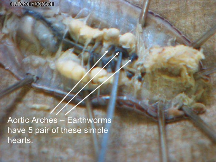 earthworm dissection continued earthworm dissection 001 earthworm dissection continued earthworm dissection 001