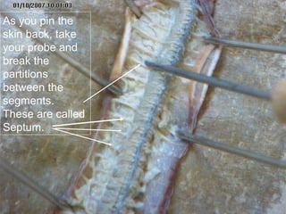 As you pin the
skin back, take
your probe and
break the
partitions
between the
segments.
These are called
Septum.
 