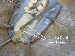 Nerve Cord
and Brain
 